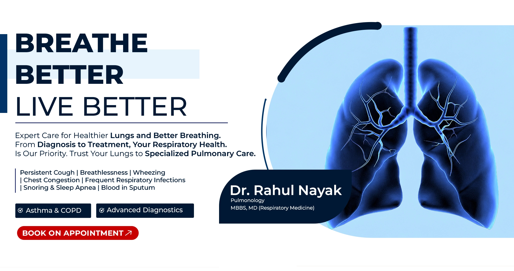 slide3
